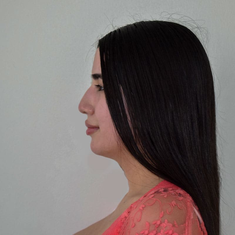 Antes